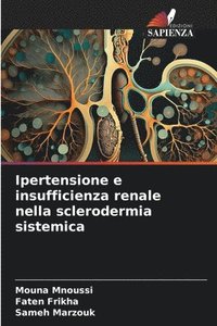 bokomslag Ipertensione e insufficienza renale nella sclerodermia sistemica