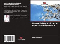 bokomslag Mesure échographique de l'épaisseur du placenta