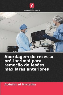 bokomslag Abordagem do recesso pré-lacrimal para remoção de lesões maxilares anteriores