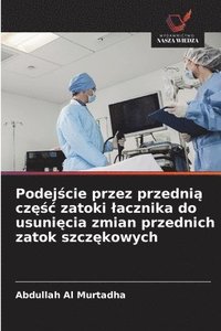 bokomslag Podej?cie przez przedni? cz??c zatoki lacznika do usuni?cia zmian przednich zatok szcz?kowych