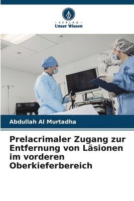 bokomslag Prelacrimaler Zugang zur Entfernung von Läsionen im vorderen Oberkieferbereich