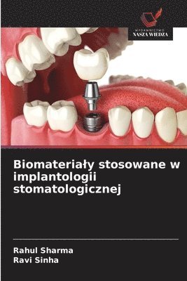 Rahul Sharma, Ravi Sinha - Biomaterialy stosowane w implantologii stomatologicznej, Häftad