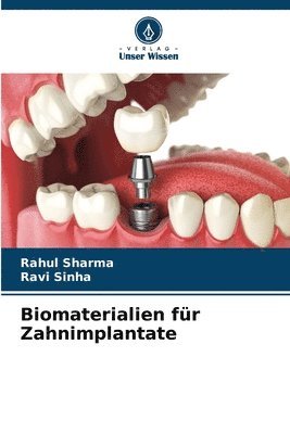 Rahul Sharma, Ravi Sinha - Biomaterialien für Zahnimplantate, Häftad