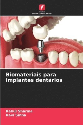 Rahul Sharma, Ravi Sinha - Biomateriais para implantes dentários, Häftad
