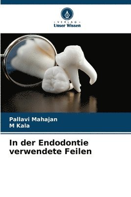 Pallavi Mahajan, M Kala, M. Kala - In der Endodontie verwendete Feilen, Häftad