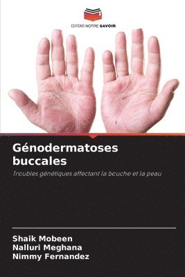 Shaik Mobeen, Nalluri Meghana, Nimmy Fernandez - Génodermatoses buccales, Häftad