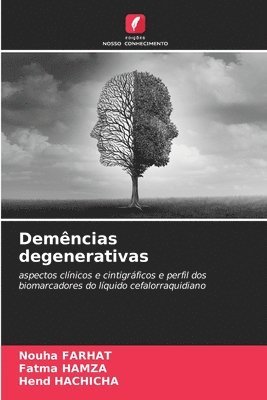 bokomslag Demências degenerativas