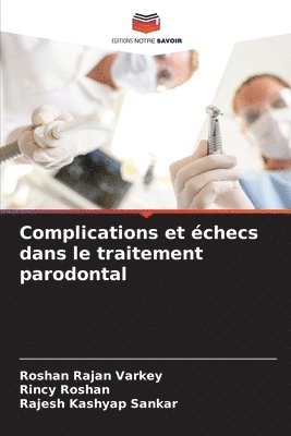 bokomslag Complications et échecs dans le traitement parodontal