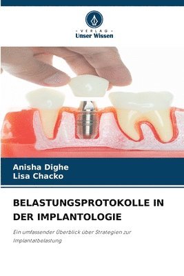 bokomslag Belastungsprotokolle in Der Implantologie