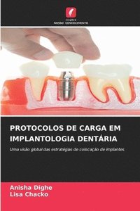 bokomslag Protocolos de Carga Em Implantologia Dentária