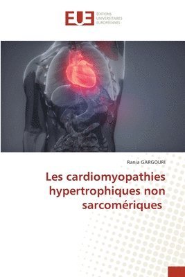 bokomslag Les cardiomyopathies hypertrophiques non sarcomériques