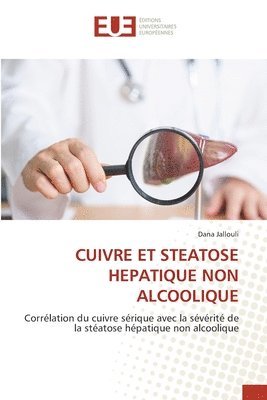 Dana Jallouli - Cuivre Et Steatose Hepatique Non Alcoolique, Häftad