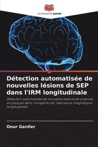 bokomslag Détection automatisée de nouvelles lésions de SEP dans l'IRM longitudinale