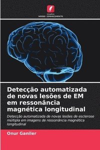 bokomslag Detecção automatizada de novas lesões de EM em ressonância magnética longitudinal