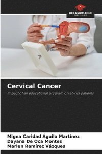 bokomslag Cervical Cancer