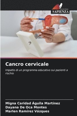 bokomslag Cancro cervicale