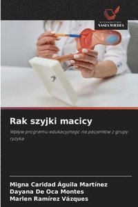 bokomslag Rak szyjki macicy
