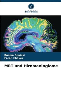 bokomslag MRT und Hirnmeningiome