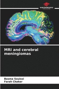 bokomslag MRI and cerebral meningiomas