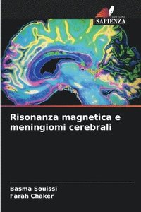 bokomslag Risonanza magnetica e meningiomi cerebrali