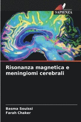 bokomslag Risonanza magnetica e meningiomi cerebrali