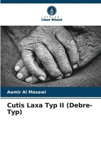 bokomslag Cutis Laxa Typ II (Debre-Typ)