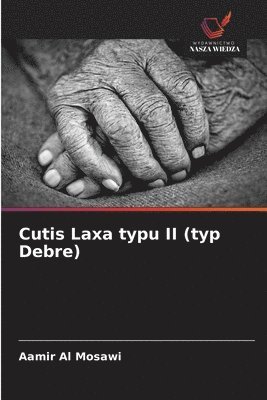 Cutis Laxa typu II (typ Debre)
