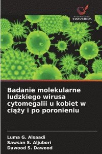 bokomslag Badanie molekularne ludzkiego wirusa cytomegalii u kobiet w ci??y i po poronieniu