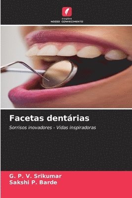 G P V Srikumar, Sakshi P Barde - Facetas dentárias, Häftad