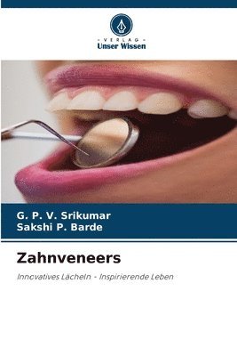 G P V Srikumar, Sakshi P Barde - Zahnveneers, Häftad