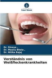 bokomslag Verständnis von Weißfleckenkrankheiten
