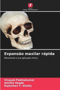 bokomslag Expansão maxilar rápida