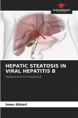 bokomslag Hepatic Steatosis in Viral Hepatitis B