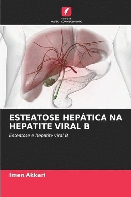 Imen Akkari - Esteatose Hepática Na Hepatite Viral B, Häftad