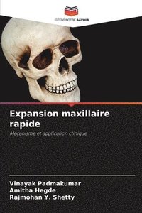 bokomslag Expansion maxillaire rapide