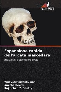 bokomslag Espansione rapida dell'arcata mascellare