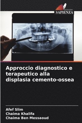 bokomslag Approccio diagnostico e terapeutico alla displasia cemento-ossea
