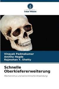 bokomslag Schnelle Oberkiefererweiterung