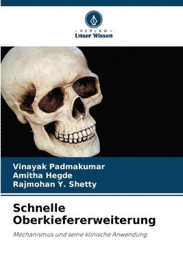Vinayak Padmakumar, Amitha Hegde, Rajmohan Y Shetty, Rajmohan Y. Shetty - Schnelle Oberkiefererweiterung, Häftad