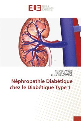 Néphropathie Diabétique chez le Diabétique Type 1