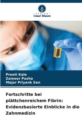 Fortschritte bei plättchenreichem Fibrin