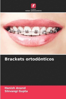 Brackets ortodônticos