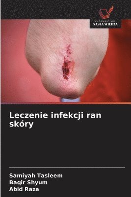 Leczenie infekcji ran skóry