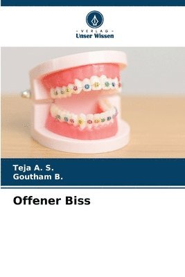 Teja A S, Goutham B, Teja A. S., Goutham B. - Offener Biss, Häftad
