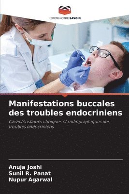 Anuja Joshi, Sunil R Panat, Nupur Agarwal - Manifestations buccales des troubles endocriniens, Häftad