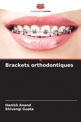 Hanish Anand, Shivangi Gupta - Brackets orthodontiques, Häftad