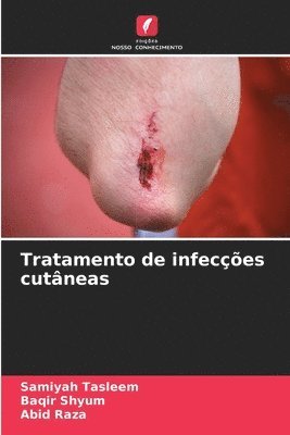 Tratamento de infecções cutâneas