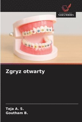 Teja A S, Goutham B, Teja A. S., Goutham B. - Zgryz otwarty, Häftad