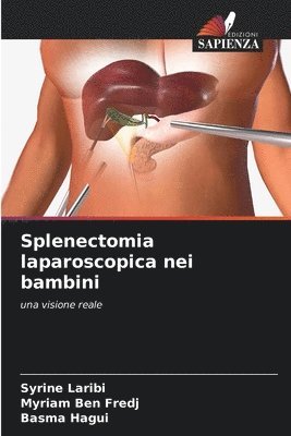 Syrine Laribi, Myriam Ben Fredj, Basma Hagui - Splenectomia laparoscopica nei bambini, Häftad