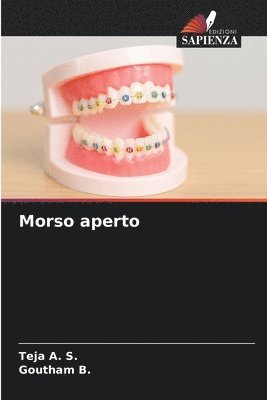 Teja A S, Goutham B, Teja A. S., Goutham B. - Morso aperto, Häftad